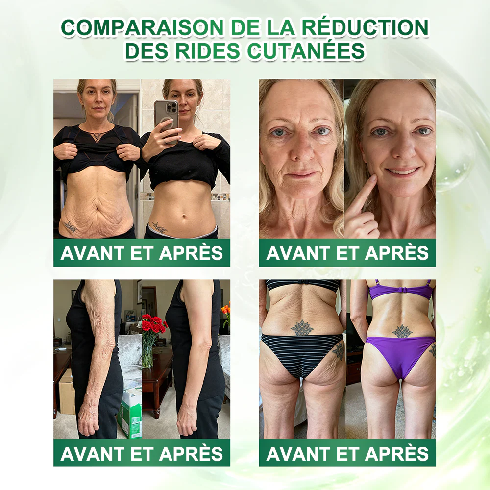🔥 NOUVEAUTÉ | Curalona® Sérum Sculptant 12-en-1 Détox Lymphatique × Berbérine ,Élimine les toxines, aide à brûler les graisses tenaces, lisse les rides et soutient le confort articulaire. - Image 7