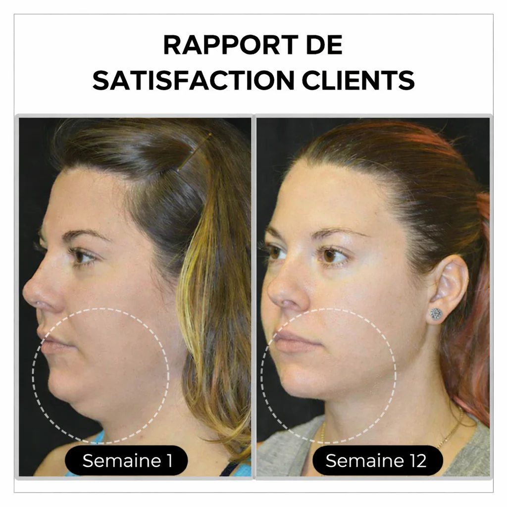 (DERNIER JOUR – SOLDES 80%)💎 Czticle® Histone Magnetology Lymphvity Boucles d’Oreilles en Germanium - Image 5