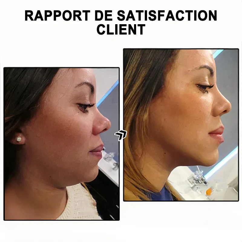 （🔥DERNIER JOUR – 80 % DE RÉDUCTION🔥) 🎉 𝐂𝐙𝐓𝐈𝐂𝐋𝐄® Lymphvity MagneTherapy Boucles d'oreilles en Germanium💎 (Portées une fois par jour, changements visibles en 7 jours) Soutien contre le surpoids, le diabète, l'apnée du sommeil et les douleurs articulaires 🍃 - Image 4