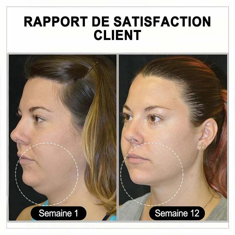 （🔥DERNIER JOUR – 80 % DE RÉDUCTION🔥) 🎉 𝐂𝐙𝐓𝐈𝐂𝐋𝐄® Lymphvity MagneTherapy Boucles d'oreilles en Germanium💎 (Portées une fois par jour, changements visibles en 7 jours) Soutien contre le surpoids, le diabète, l'apnée du sommeil et les douleurs articulaires 🍃 - Image 7