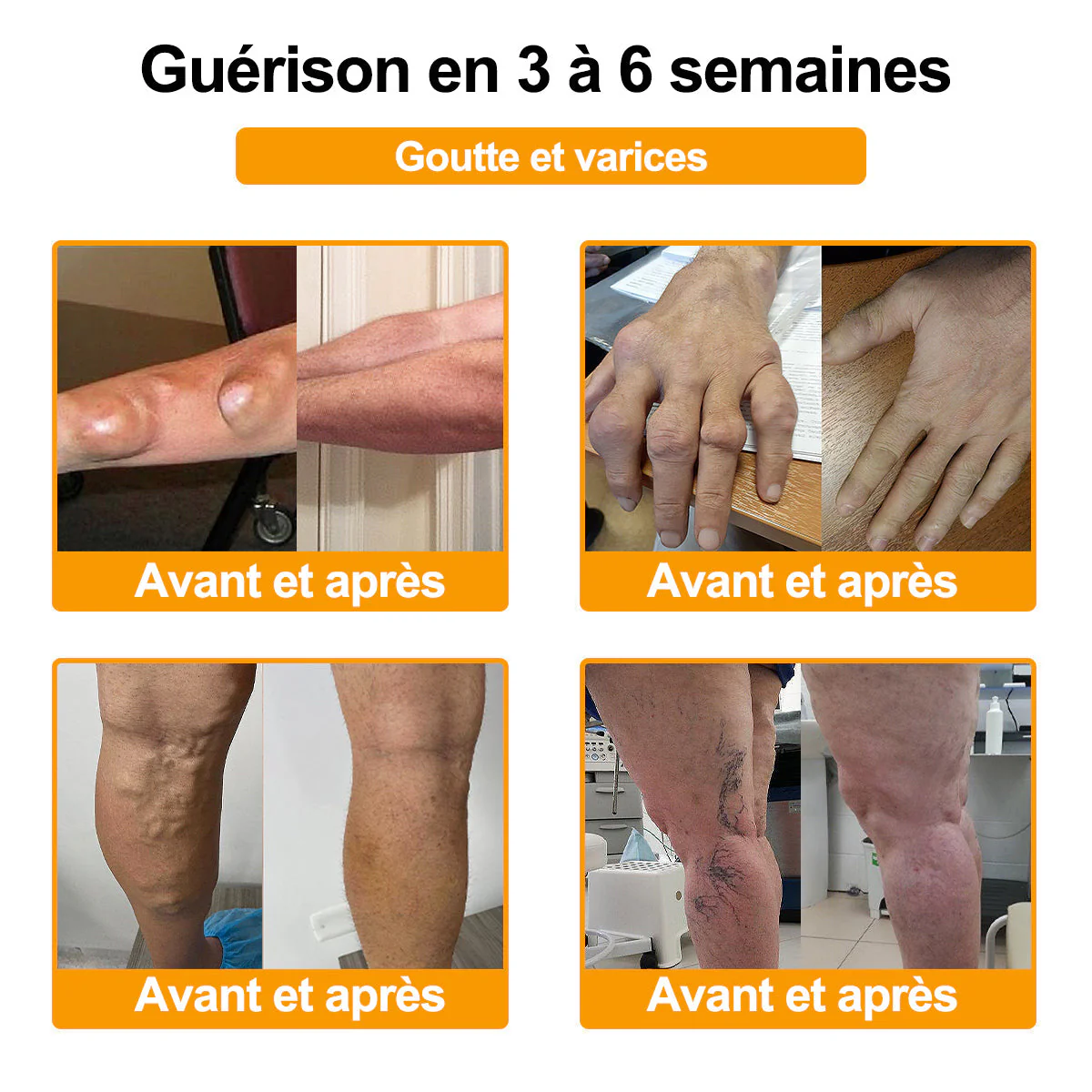 Purelora® Venin d'abeille Crème cicatrisante osseuse Pain-Relief 🐝🐝(Spécialement conçu pour les personnes âgées ) - Image 4